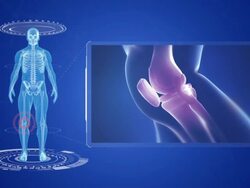 Knee pain animation. Stock Footage