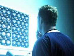 Doctor Looking At X-Ray Stock Footage