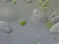 Ciliates and algal cells. Ciliates are feeding on bacteria and other microorganisms. Recorded using Nomarski Differential Interference Contrast horizontal field of view is 260 micrometres. Stock Footage