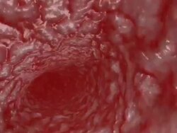 Artery tunnel Stock Footage