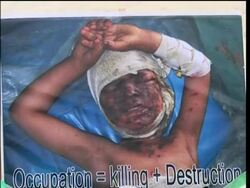 Rally against alleged killing of 52 civilians in NATO strike News Clip