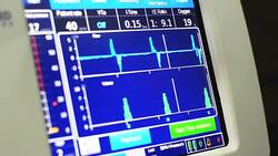 Medical ventilator Stock Footage