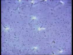 US soldiers store sperm before leaving for Gulf News Clip