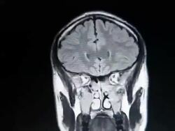 MRI brain scan Stock Footage