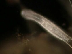 Gastrotrich moving through organic matter underwater. Stock Footage