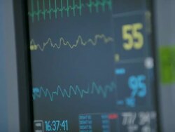Patient Vitals Monitor Stock Footage