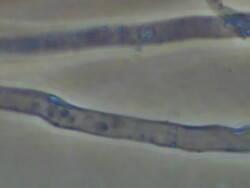 Dry rot fungus (Serpula lacrymans) hyphae, UK Stock Footage