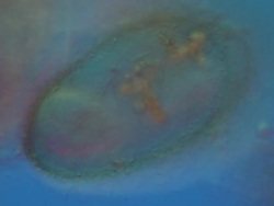 Egg containing miracidium stage of Liver Fluke Fasciola hepatica showing cilia. Sample contaminated with many bacteria. Differential interference contrast horizontal field of view about 160 microns. Stock Footage