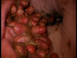 MS Horse Bot Fly, Gasterophilus intestinalis, larvae in horse stomach, United Kingdom Stock Footage