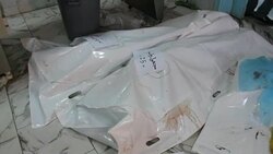 CLEAN : Libyan air strike kills dozens bodies lie in hospital News Clip