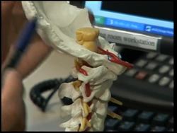 A woman decapitated in a car accident rebuilds her life News Clip