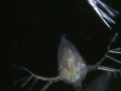 Endoscope view of Water flea (Daphnia sp.). Sony PMW-EX3 Full HD video camera with endoscope, horizontal field of view is 3mm and slow motion at 60 fps. Stock Footage