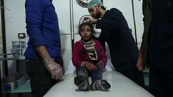 CLEAN : Syria: children treated at Eastern Ghouta clinic after strikes News Clip