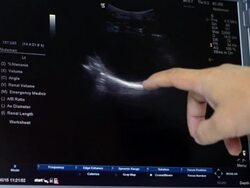 Ultrasound Stock Footage