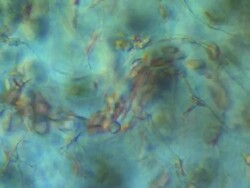 Differential Interference Contrast view of Toad (Bufo bufo) tadpole tail capillary. Olympus BH-2 microscope, Olympus S-Plan 10x objective, NFK 5x photoeyepiece. Stock Footage