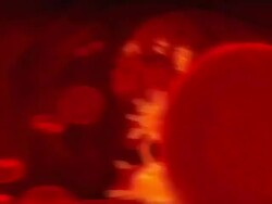 Virus attack! Stock Footage