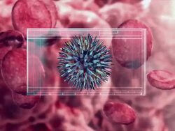 CU Microscopic view of virus being identified and analyzed / Melbourne, Victoria, Australia Stock Footage
