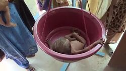 VOICED : In Pakistan low breastfeeding rates leads to stunted growth cr News Clip
