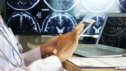 Doctor in white coat is using modern smartphone with Brain X-ray image Stock Footage