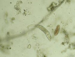 Two micro organisms - zoom in Stock Footage