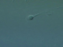 Single Human sperm swimming, big close up, Interference contrast Stock Footage