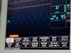 Patient monitor Stock Footage