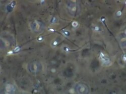 Human sperm Stock Footage