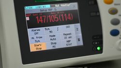 vital signs monitor Stock Footage