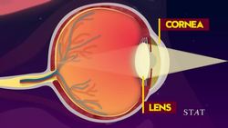 Boddities | Episode 5 | Why do bright lights make us see spots? Instructional Video