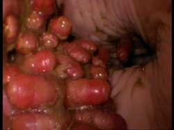 MS Horse Bot Fly, Gasterophilus intestinalis, larvae in horse stomach, tilt up and down, United Kingdom Stock Footage