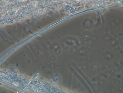Large Ciliate foraging for bacteria among sewage fungus hyphae. Phase Contrast illumination. Stock Footage