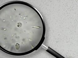 Sperm viewed through magnifying glass Stock Footage