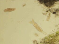 Micro organisms swimming Stock Footage