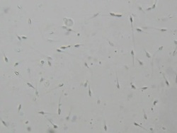 Sperm under microscope 400x Stock Footage