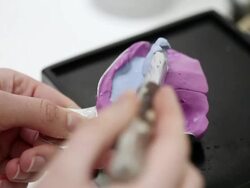 Dental prosthesis Stock Footage