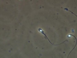 Two Human sperm swimming, best, Phase contrast Stock Footage