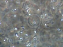 Human sperm, lots swimming around, locked off Stock Footage