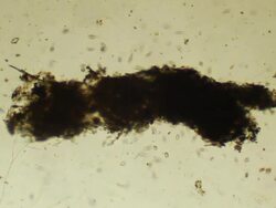 Micro organisms Stock Footage