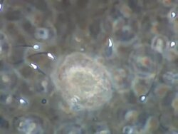 Human sperm around egg-like sphere Stock Footage