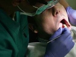 Dental Examination Stock Footage
