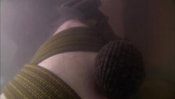 A leech under water attaches itself to a man's leg and swells as it sucks his blood. Stock Footage