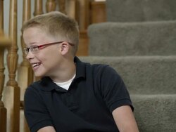 Boy with scar on head from birth defect Stock Footage