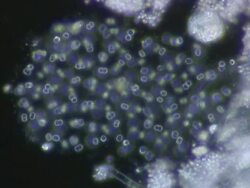 Blue Green Algae colony Aphanothece Stock Footage