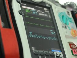 Defibrillator Stock Footage