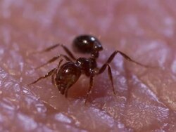 Extreme Close Up - Fire ant stinging human skin /  Stock Footage