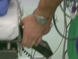 Doctors monitoring vital signs of a patient Stock Footage