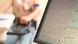 Medicine. ECG displayed on monitor. Stock Footage