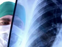 Doctor looks at x-rays Stock Footage