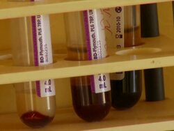 CU Blood filled test tubes at doctors without borders facilities / Juba, Central Equatoria, Sudan  Stock Footage