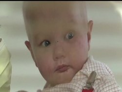 A Texas toddler has a form of anemia so rare it's been named for her. After 40 blood transfusion and a bone marrow transplant she is still fighting and now getting better every day. News Clip